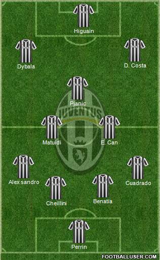 Juventus Formation 2018