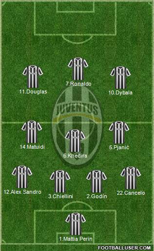 Juventus Formation 2018