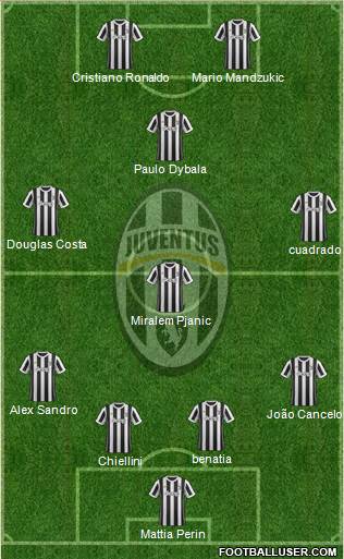 Juventus Formation 2018