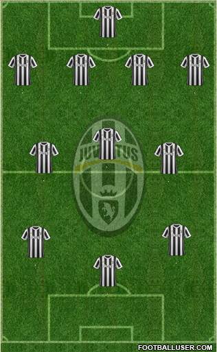 Juventus Formation 2018