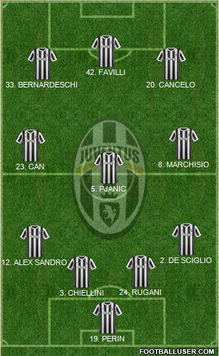Juventus Formation 2018