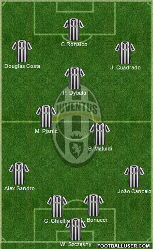 Juventus Formation 2018