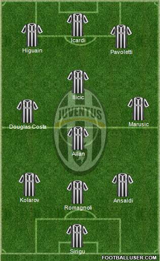 Juventus Formation 2018