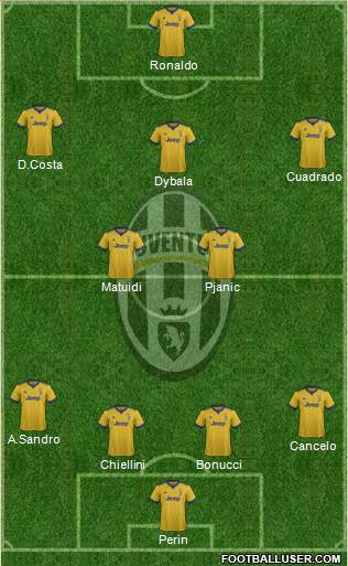 Juventus Formation 2018