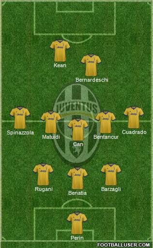 Juventus Formation 2018