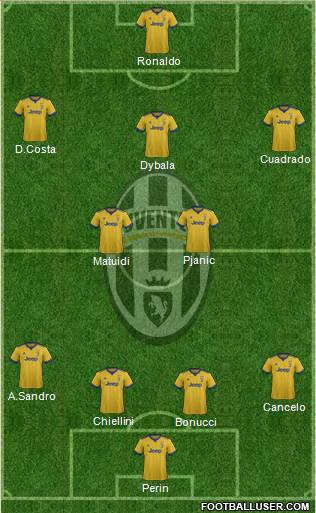Juventus Formation 2018