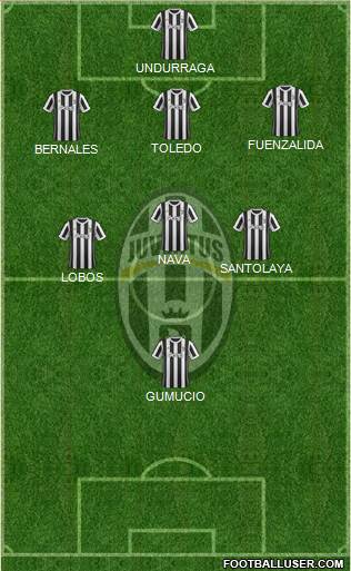 Juventus Formation 2018