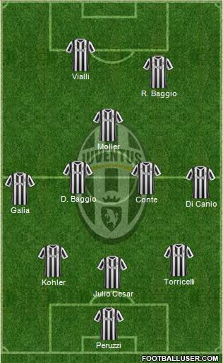 Juventus Formation 2018