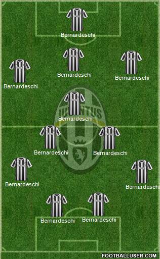 Juventus Formation 2018