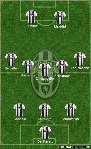 Juventus Formation 2018