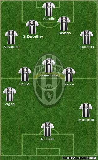 Juventus Formation 2018