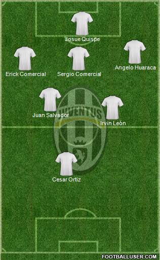 Juventus Formation 2018