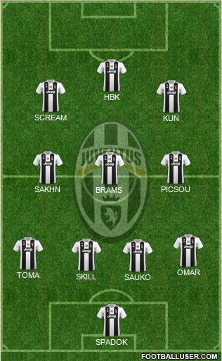 Juventus Formation 2018