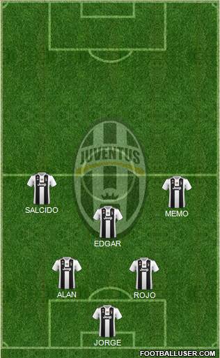 Juventus Formation 2018