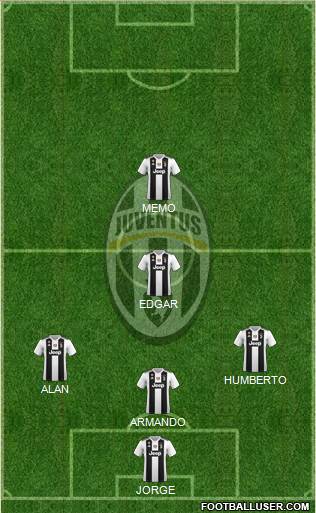Juventus Formation 2018