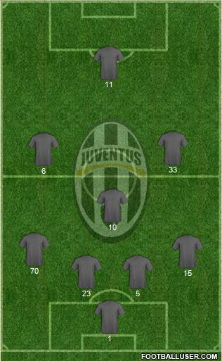 Juventus Formation 2022